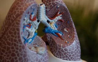 EPOC de origen laboral - Novagés